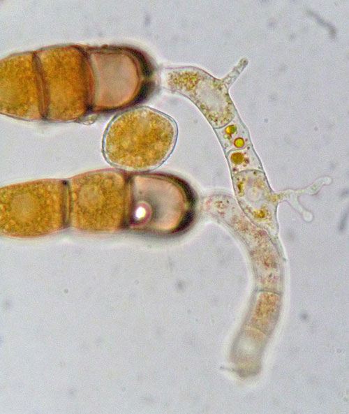 Frommeella mexicana: germinating teliospores