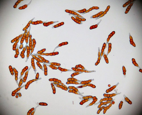 Frommeella mexicana: teliospores