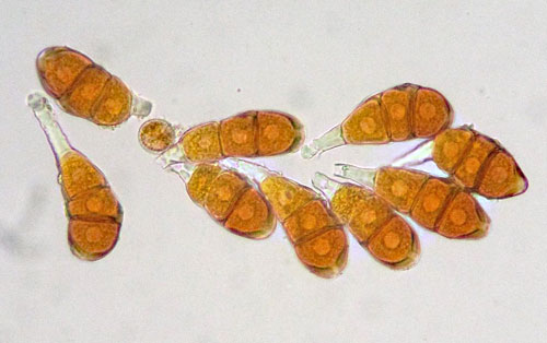 Frommeella mexicana: teliospores