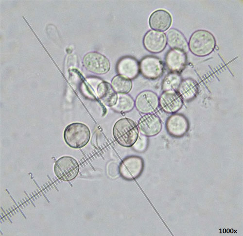 Tuberculina persicina conidia