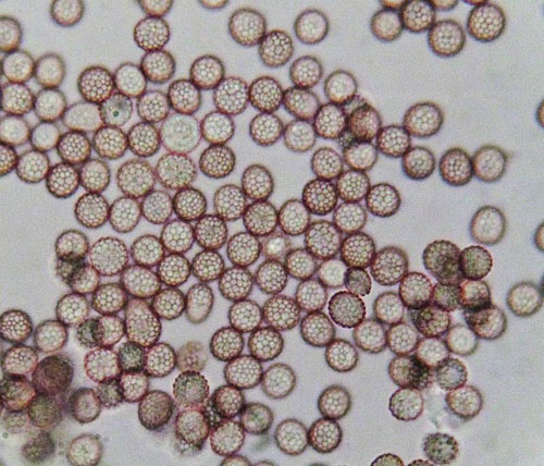 Microbotryum lychnidis-dioicae: spores