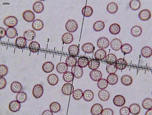 Microbotryum lychnidis-dioicae: spores
