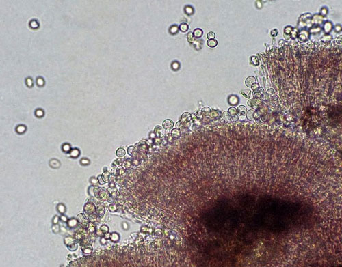 Tuberculina persicina: sporodochium, sectioned
