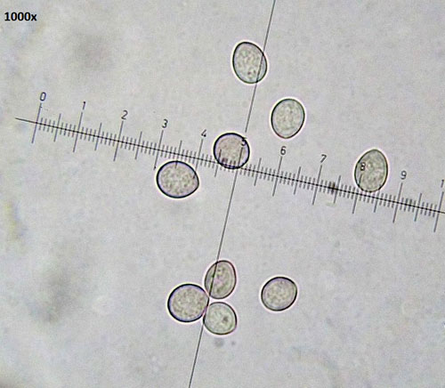 Tuberculina persicina: conidia