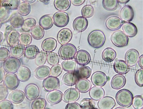 Tuberculina persicina: conidia