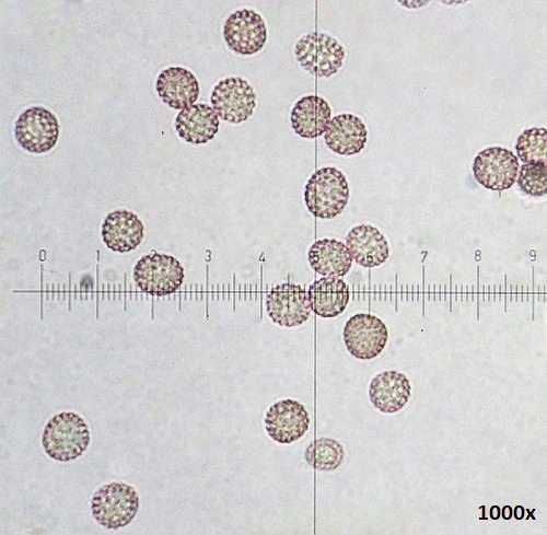 Microbotryum saponariae: spores