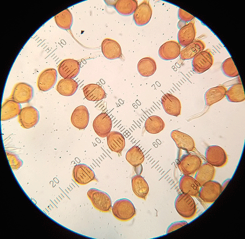 Uromyces inaequialtus on Silene nutans