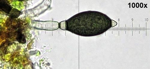 Brachydesmiella biseptata