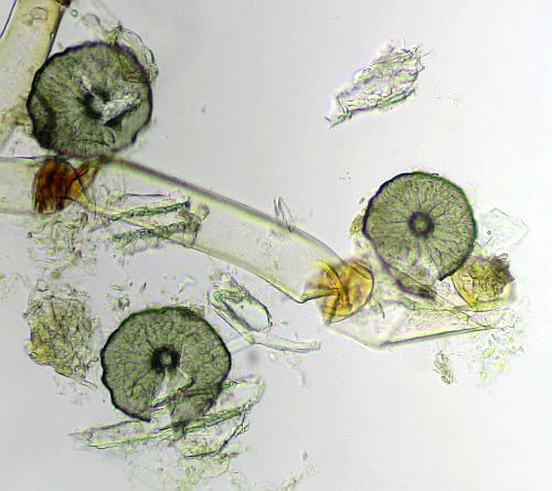 Lichenopeltella nigroannulata on Pterdidium aquilinum
