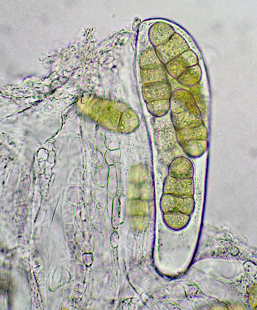 Pyrenophora trichostoma