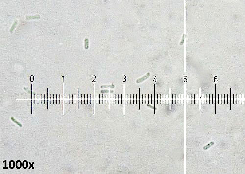 Asteromella platanoidis on Acer pseudoplatanus