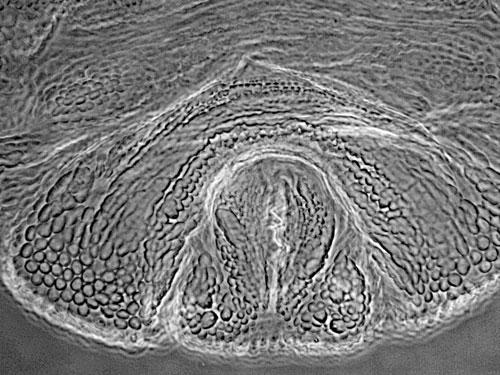 Dasineura interbracta