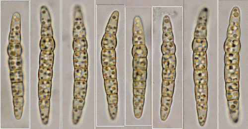 Phaeosphaeria herpotrichoides on Miscanthus sinensis