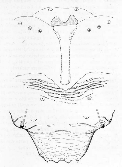 Contarinia medicaginis