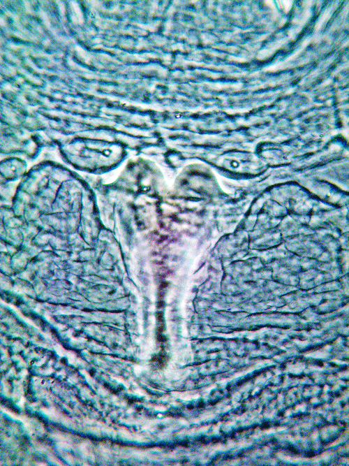 Macrolabis pavida