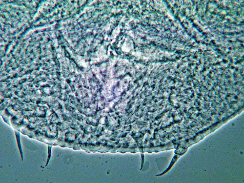 Macrolabis pavida