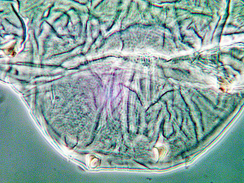 Contarinia campanulae
