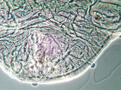 Cpntarinia medicaginis