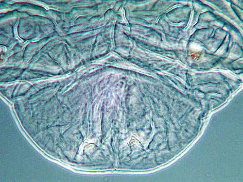 Contarinia solani