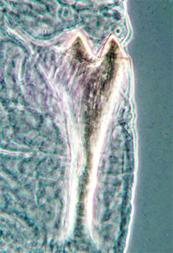 Contarinia tremulae