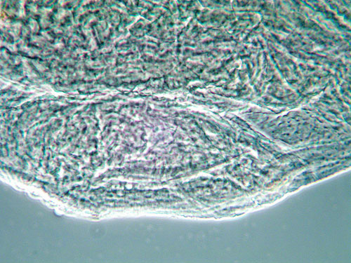 Contarinia tremulae