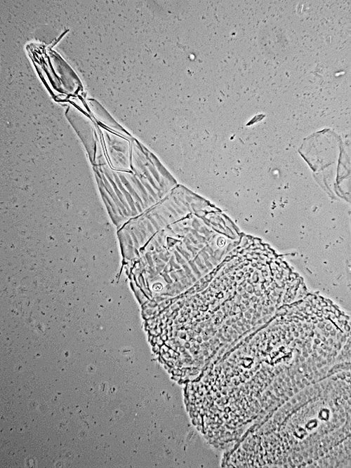 Arthrocnodax spec. on Betula pubescens