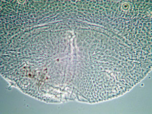 Dryomyia circinans on Quercus spec.