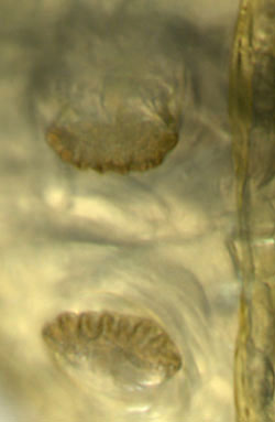 14130_aspd