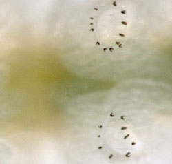 Leucoptera laburnella larva