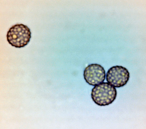 Microbotryum saponariae: spores