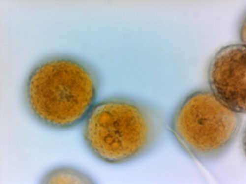 Frommeëlla mexicana: urediniospores