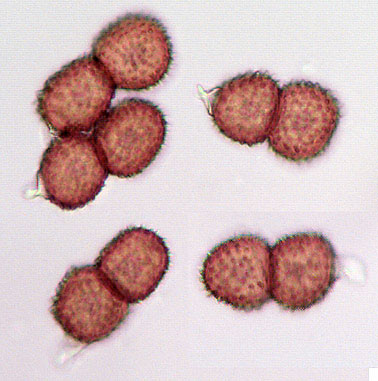 Tranzschelia anemones: teliospores