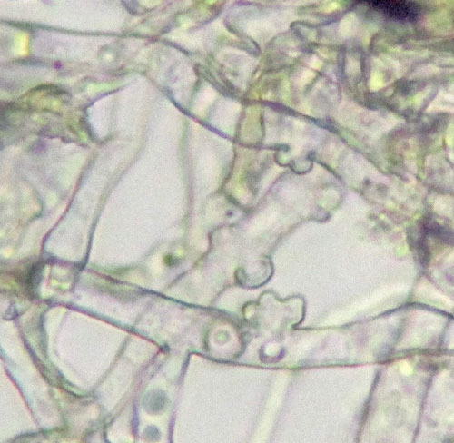Pseudoidium hortensiae on Hydrangea: appressoria