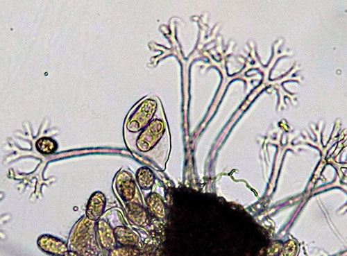 Erysiphe vanbruntiana: ascus