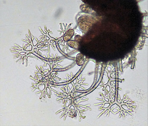 Erysiphe vanbruntiana: cleistothecia