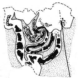 Parafomoria tingitella mine
